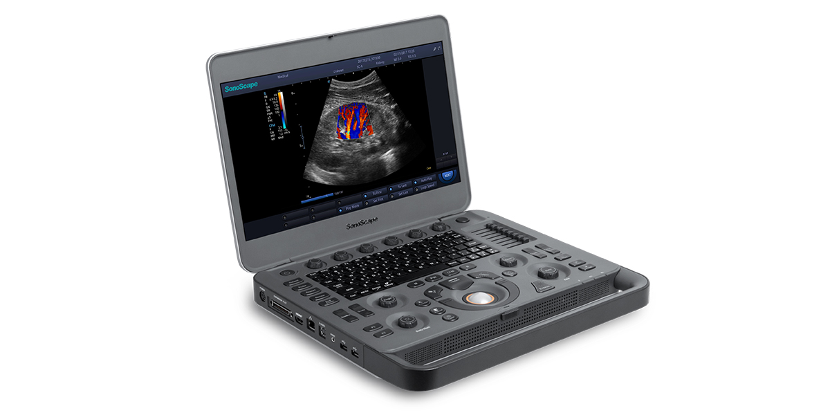 sonoscape-x3-portable-taşınabilir-ultrason-cihazi-ultrasound