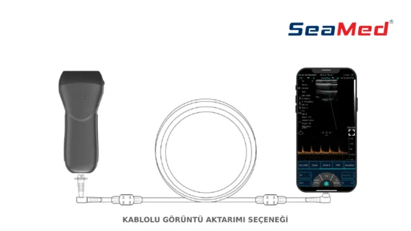 SEAMED LINEER EL TİPİ KABLOSUZ ULTRASON - Görsel 3