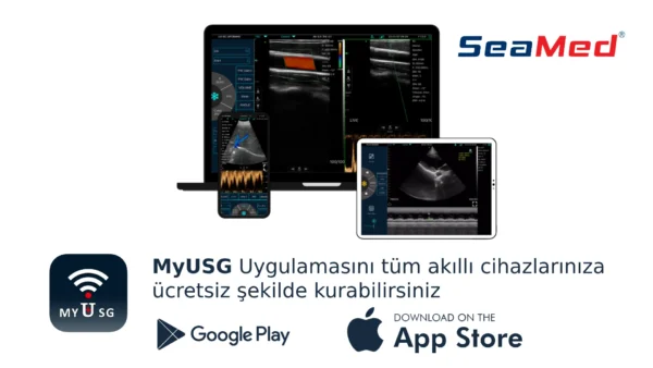 SEAMED LINEER EL TİPİ KABLOSUZ ULTRASON - Görsel 4