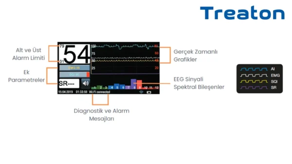 MGA-06 ANESTEZİ DERİNLİK MONİTÖRÜ (BIS MONİTÖRÜ) - Görsel 4