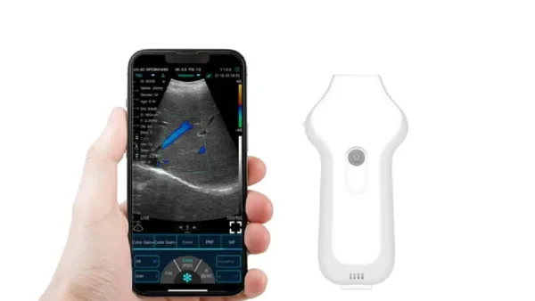 SEAMED KARDİYAK EL TİPİ KABLOSUZ ULTRASON - Görsel 2