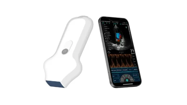 SEAMED KARDİYAK EL TİPİ KABLOSUZ ULTRASON - Görsel 4