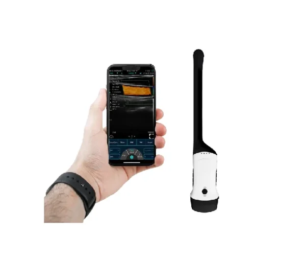 SEAMED KONVEKS + TRANSVAJİNAL EL TİPİ KABLOSUZ ULTRASON - Görsel 3